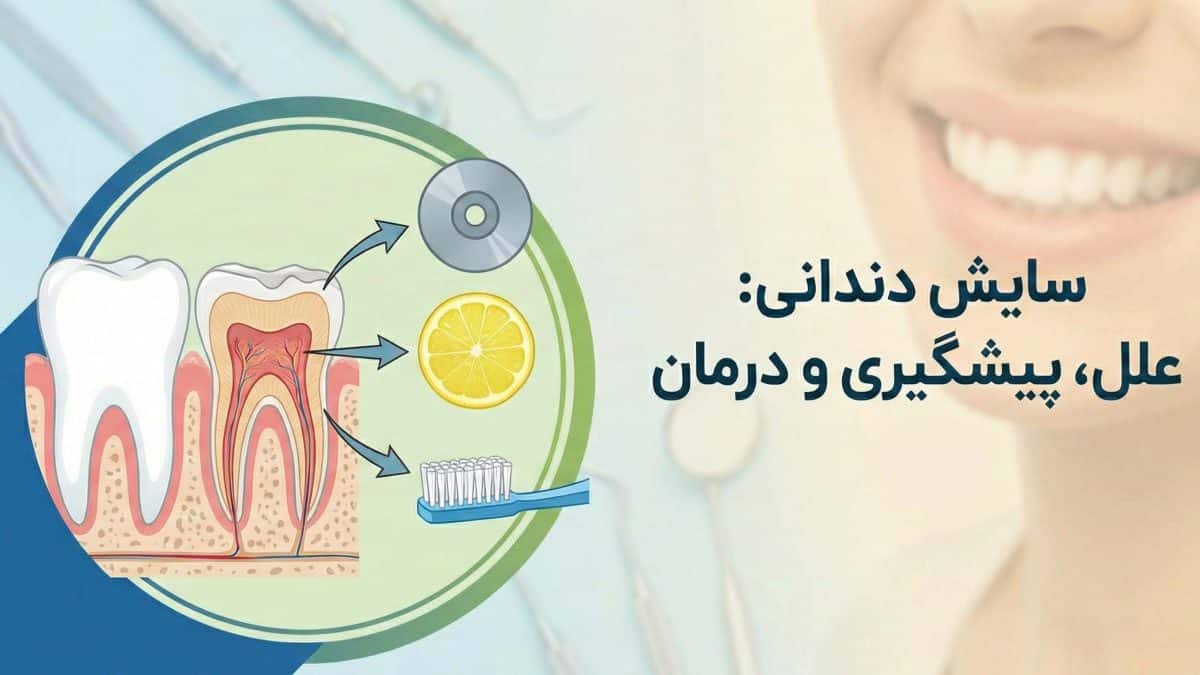 مقاله سایش دندان