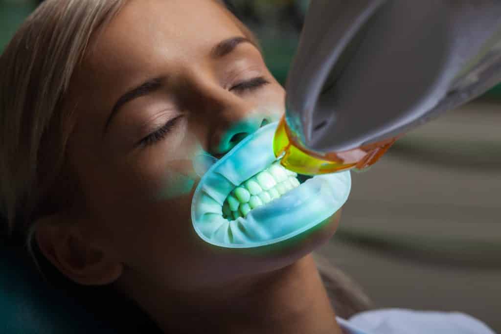 مراقبت های بعد از سفید کردن دندان