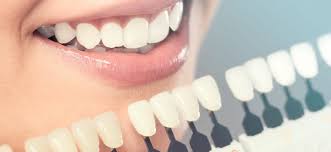 تاثیر رنگ دندان در طرح لبخند دندان
