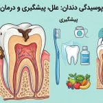 علت و درمان پوسیدگی دندان