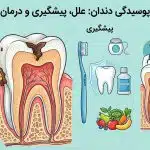 علت و درمان پوسیدگی دندان